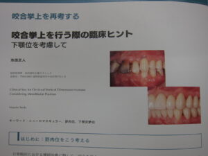 ザ、クインテッセンスに論文掲載されました！