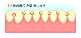 floss01