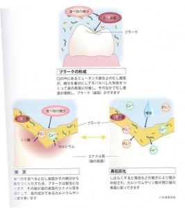歯の脱灰と再石灰化