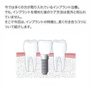 インプラント治療後の患者さまにご満足いただいております！